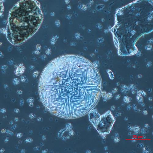 星脐圆筛藻1.jpg 星脐圆筛藻1.jpg