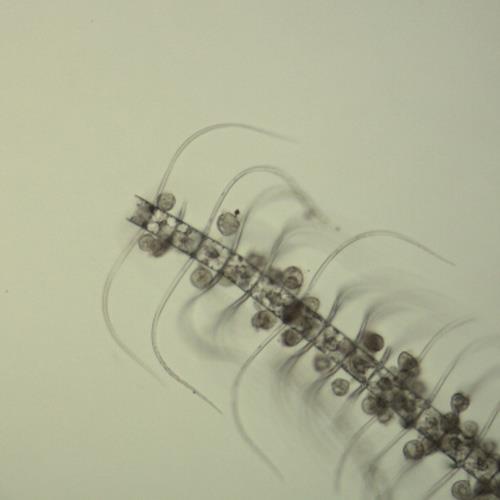 密聚角毛藻.jpg 密聚角毛藻.jpg