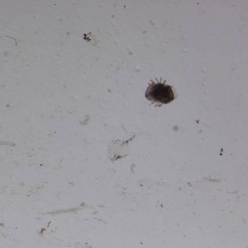 浮游动物检测 浮游动物检测